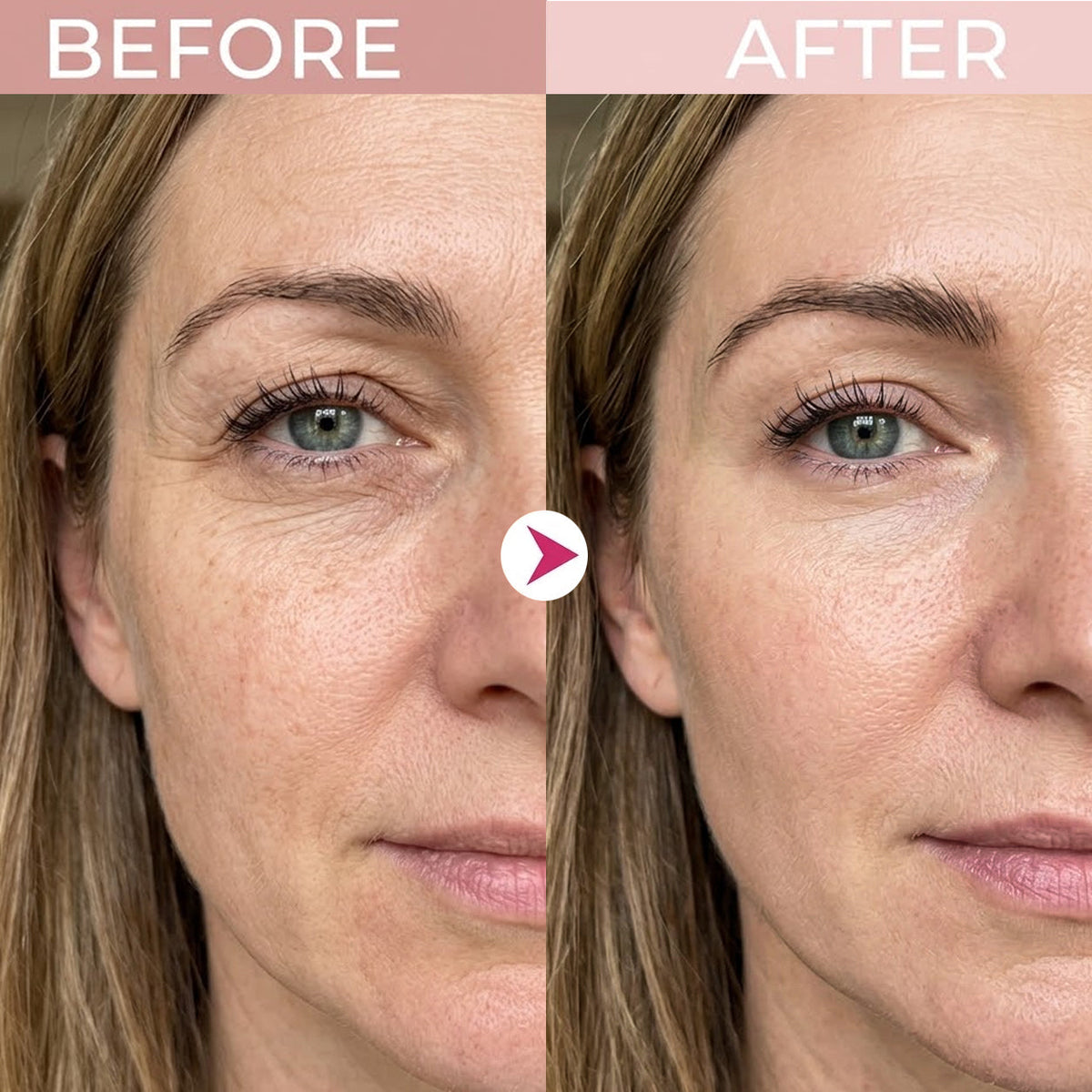 💖Trusted-by-over-50,000-women💖 Eye Renewal Creme