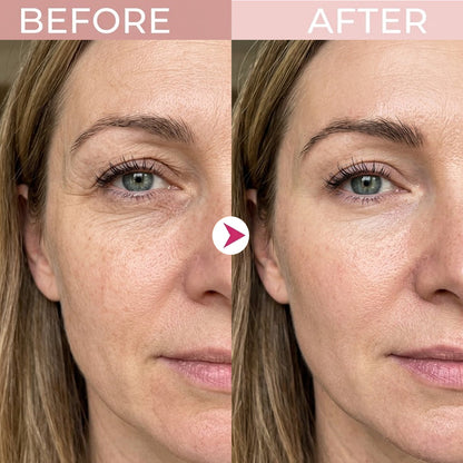 💖Trusted-by-over-50,000-women💖 Eye Renewal Creme