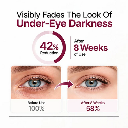 💖Trusted-by-over-50,000-women💖 Eye Renewal Creme
