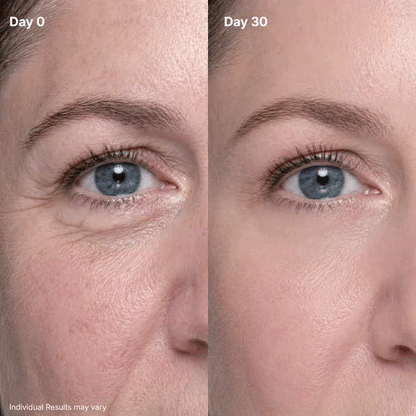 💖Trusted-by-over-50,000-women💖 Eye Renewal Creme